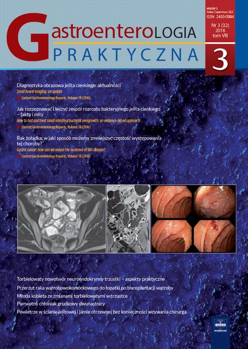 Gastroenterologia Praktyczna 3/2016