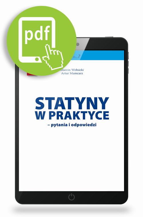 Statyny w praktyce - pytania i odpowiedzi