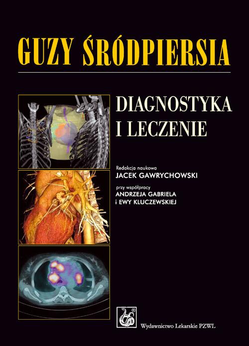 Guzy śródpiersia. Diagnostyka i leczenie