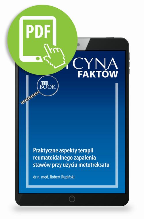 Praktyczne aspekty terapii reumatoidalnego zapalenia stawów przy użyciu metotreksatu