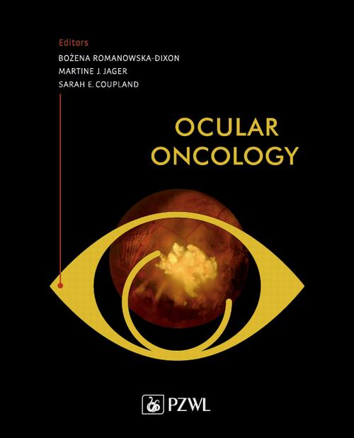 Ocular Oncology
