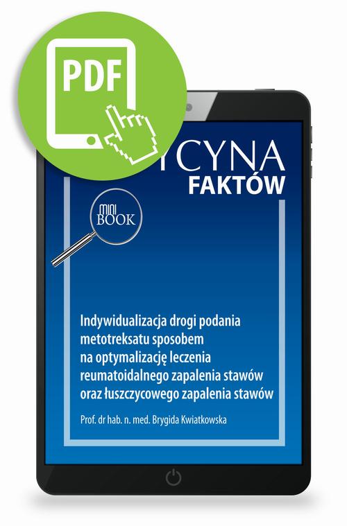 Indywidualizacja drogi podania metotreksatu sposobem na optymalizację leczenia reumatoidalnego zapalenia stawów oraz łuszczycowego zapalenia stawów [Medycyna Faktów 1/2023]